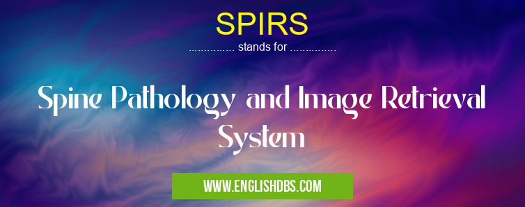 SPIRS