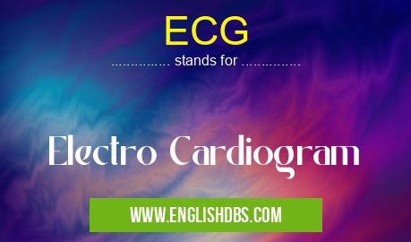 ECG