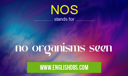 NOS